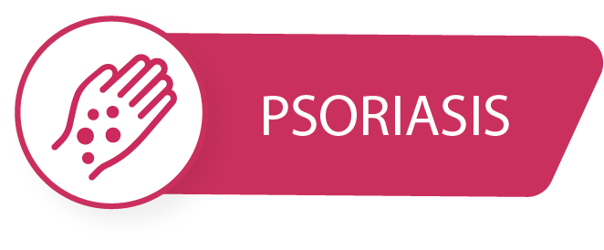 psoriasis